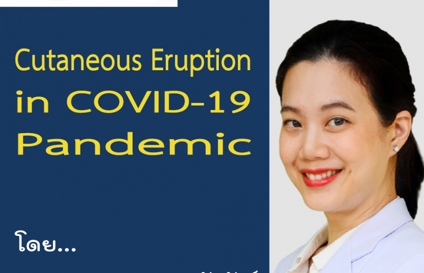 Cutaneous Eruption in COVID-19 Pandemic