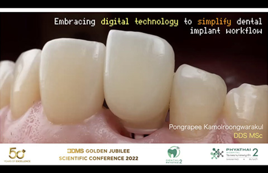Embracing digital technology to simplify dental implant workflow.