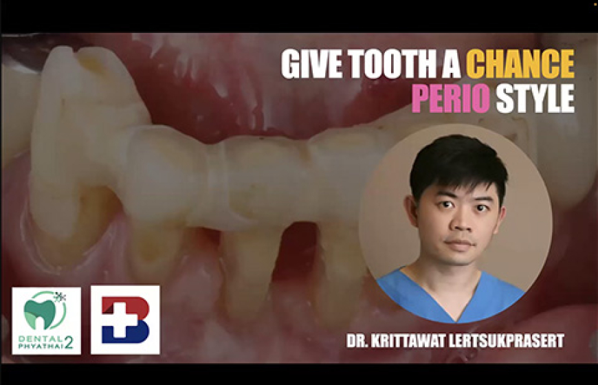 Give tooth a chance, Perio style.
